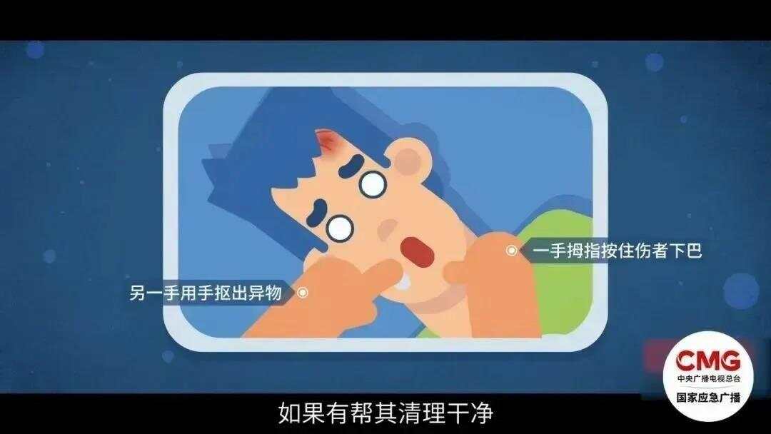 九游娱乐网站:天降乌龟砸中幼童致死关于高空坠物这些知识要知道(图7)